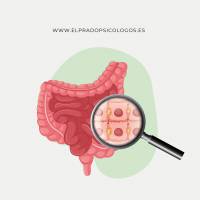 qué es el colon irritable