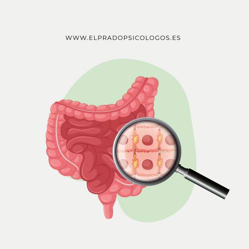 Colon Irritable Tratamiento Intestino Irritable